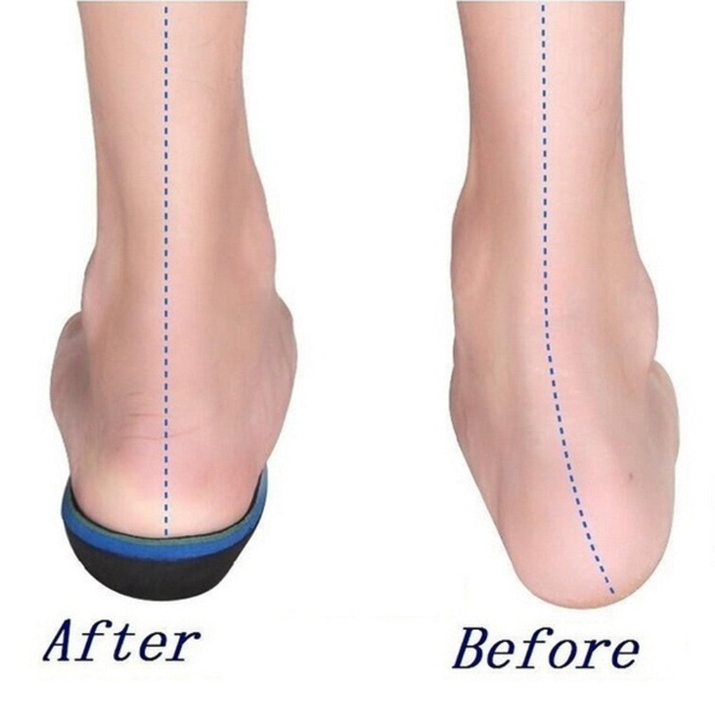 5 benefits of using Custom Footwear