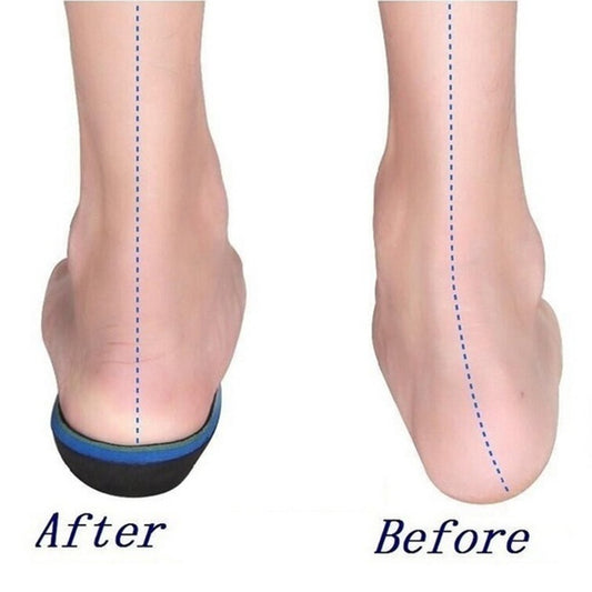 5 benefits of using Custom Footwear