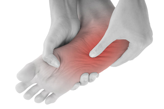 Top 4 treatments for arch pain