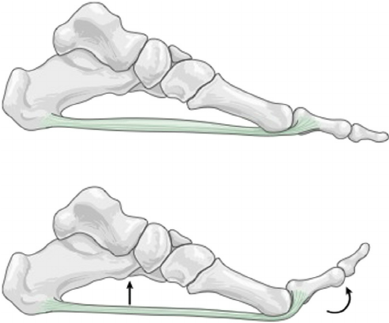 The windlass mechanism of your foot