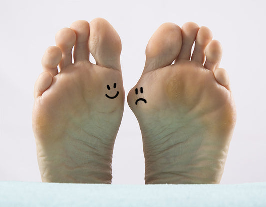bunions