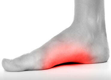 What is arch pain?