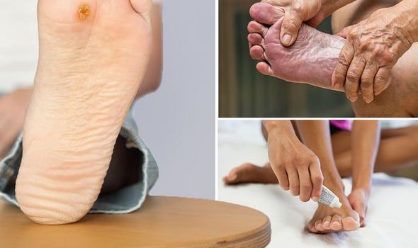 Foot problems which scares diabetic people