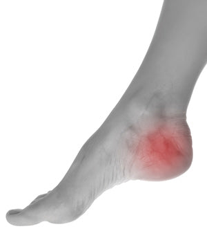 heel-pain-solution-and-plantar-fasciitis